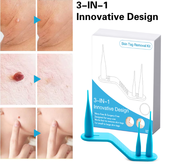 PureDerm Remove Pen